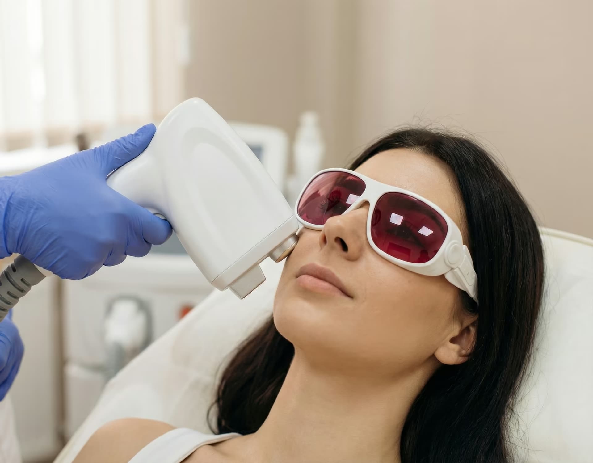 Лазерная эпиляция